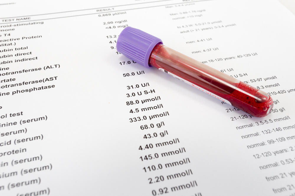 A blood sample tube resting on a printed lab results sheet
